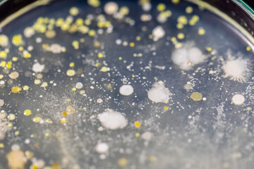 Backgrounds of Characteristics and Different shaped Colony of Bacteria and Mold growing on agar plates from Soil samples for education in Microbiology laboratory.
