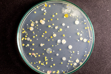 Backgrounds of Characteristics and Different shaped Colony of Bacteria and Mold growing on agar plates from Soil samples for education in Microbiology laboratory.
