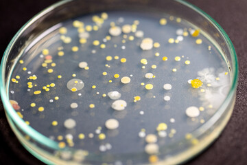 Backgrounds of Characteristics and Different shaped Colony of Bacteria and Mold growing on agar plates from Soil samples for education in Microbiology laboratory.

