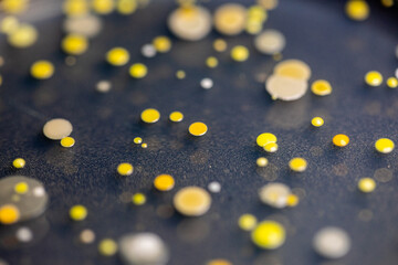 Backgrounds of Characteristics and Different shaped Colony of Bacteria and Mold growing on agar plates from Soil samples for education in Microbiology laboratory.
