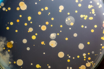 Backgrounds of Characteristics and Different shaped Colony of Bacteria and Mold growing on agar plates from Soil samples for education in Microbiology laboratory.
