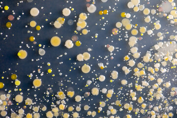 Backgrounds of Characteristics and Different shaped Colony of Bacteria and Mold growing on agar plates from Soil samples for education in Microbiology laboratory.
