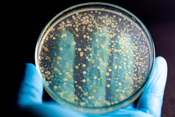 Backgrounds of Characteristics and Different shaped Colony of Bacteria and Mold growing on agar plates from Soil samples for education in Microbiology laboratory.
