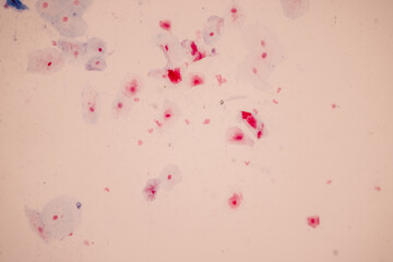 Characteristics of anatomy and Histological sample Squamous epithelial cells under microscope, Human and isolated Cell.
