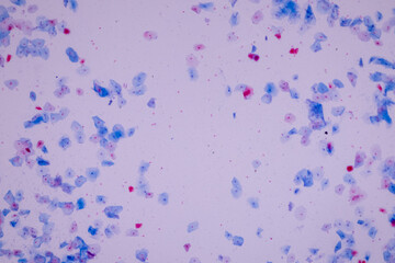 Characteristics of anatomy and Histological sample Squamous epithelial cells under microscope, Human and isolated Cell.
