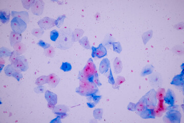 Characteristics of anatomy and Histological sample Squamous epithelial cells under microscope,...
