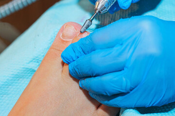 A gloved handler prepares the nail plate of the toe for gel coating.