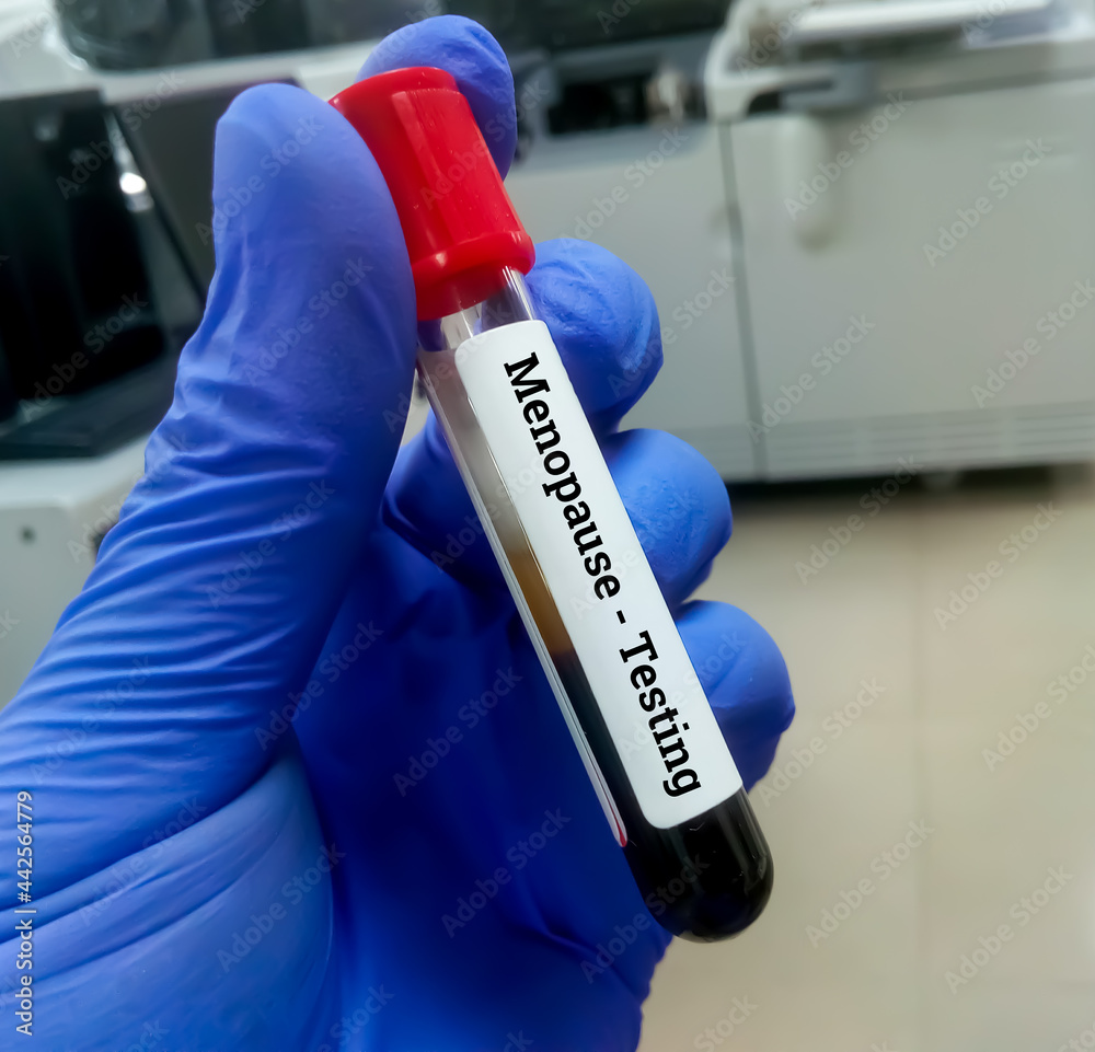 Canvas Prints Scientist hold blood sample for Menopausal testing.