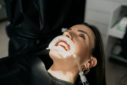 Female with saliva ejector and retractor in mouth