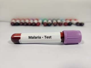 Test Tube with blood sample for Malaria Parasite test. Diagnosis for malaria fever. Test in the...