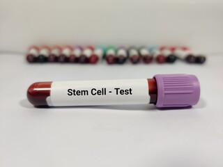 Test Tube with blood sample for stem cell test in the laboratory background.