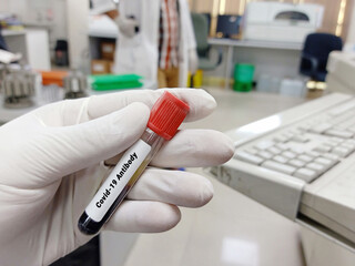 Biochemist or Lab Technologist holds Blood samples for Covid-19 antibody test in the laboratory. Biochemistry lab Close view. IgG, IgM test of Covid-19.
