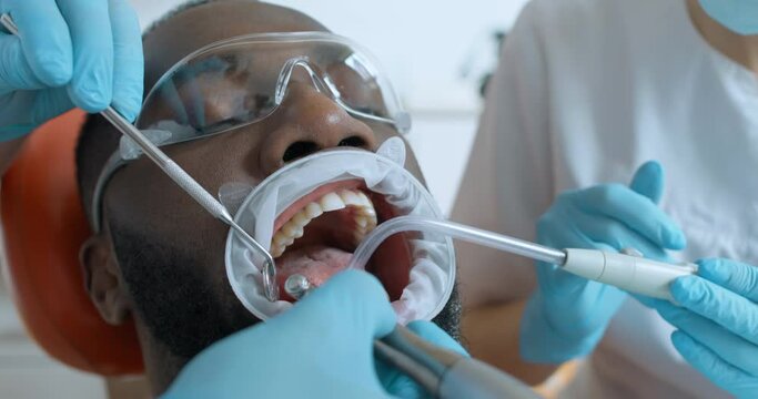 Close-up an African American male patient in disposable eyeglasses and in an optragate is having teeth cleaning by using a dental brush, mirror, saliva ejector.