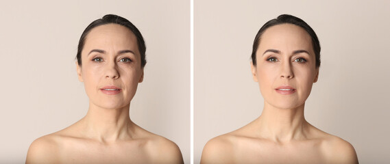 Photo before and after retouch, collage. Portrait of beautiful mature woman on beige background,...