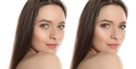 Photo before and after retouch, collage. Portrait of beautiful young woman on white background,...