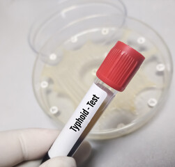 Test Tube with blood sample for Typhoid test with sensitivity plate, diagnosis of typhoid or paratyphoid fever. A medical testing concept in the microbiology lab background