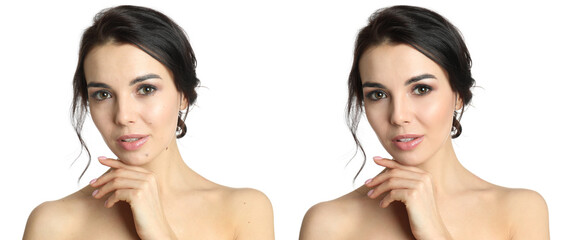 Photo before and after retouch, collage. Portrait of beautiful young woman on white background,...