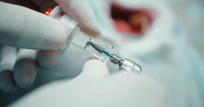 Dental implant surgery. Screwing the implant on the tool.