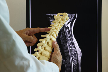 Doctor holding cervical spine model and MRI on background