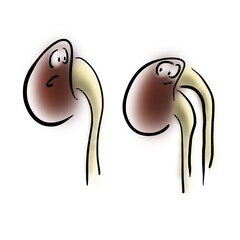 Normal kidney and double kidney