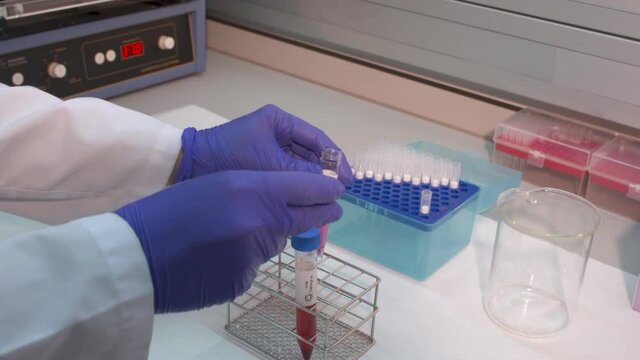 Laboratorio. Pipeteo 1
