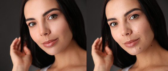 Photo before and after retouch, collage. Portrait of beautiful young woman on dark background,...