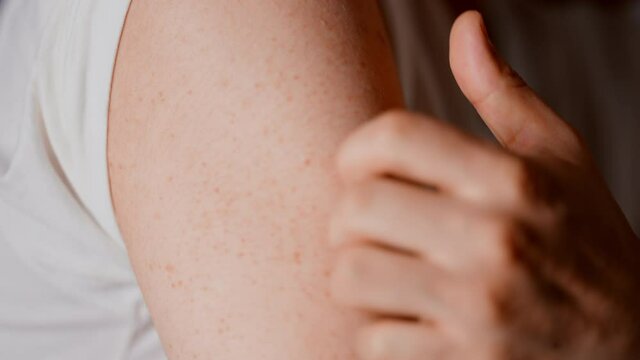 二の腕を掻く男性　アトピー性皮膚炎イメージ