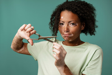 Young woman with vitiligo cutting her hair and looking at camera