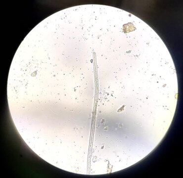 Close up parasite eggs in stool exam.