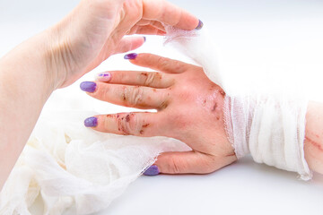 woman bandage hand