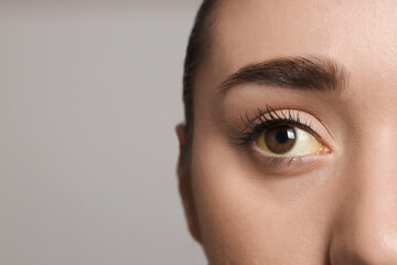 Woman with yellow eyes on grey background, closeup and space for text. Liver problems symptom