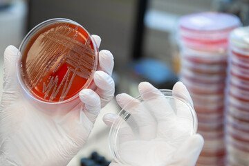 petrischale Kultur Pilze Bakterien Anzucht Mikroorganismus