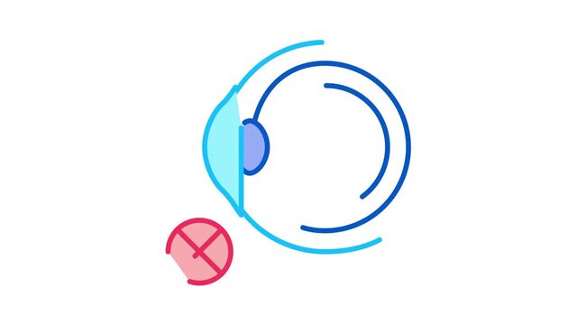 Eyeball Glaucoma Icon Animation. color Eyeball Glaucoma animated icon on white background