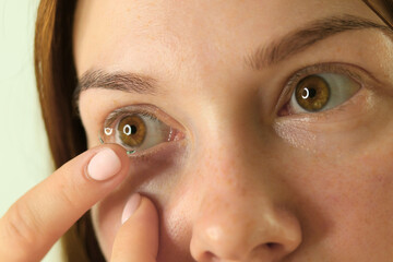A young woman inserts contact lenses into her right eye