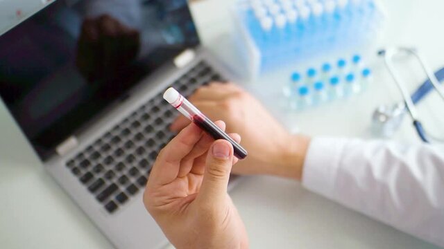 The doctor works in the laboratory. He compiles a laboratory report on his immunological studies, holding a sample of healthy blood in a test tube. Look through the eyes.