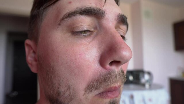 Comic Shot. Man Picking His Nose, Close-up. He Wrinkles His Face and Mimics. Stuffy Nose or Loss of Smell, Scratches his Itchy Nose