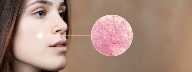 Profile of woman with brown eyes and brown hair, microscopic enlargement of the skin of the cheek