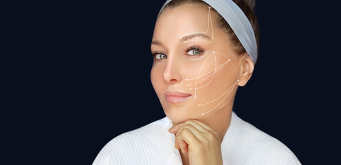 thread lift procedure ,non-surgical facelift,markup