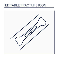 Metal plates line icon. Implanted metal can help broken bones heal in proper alignment.Treatment. Healthcare concept. Isolated vector illustration. Editable stroke