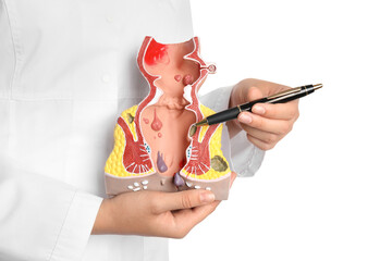 Doctor pointing at model of unhealthy lower rectum with inflamed vascular structures on white...