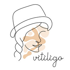 International vitiligo day. Simple line art woman face with skin problems. Outline Person clipart. Abstract portrait girl in hat.