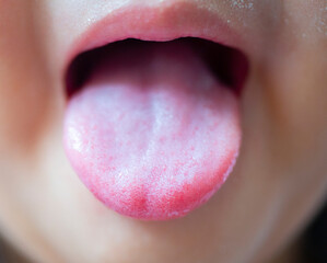 image of a person's tongue