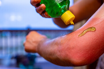 applying aloe vera gel to a red sunburn on an arm