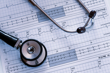 Items in a professional's office. Stethoscope over an EKG like cardiac arrhythmias.