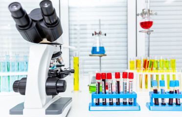 Room test tubes and lab samples of coronavirus diagnostic blood test mock-up bottle of covid-19 vaccine microscope in medical research laboratory or science laboratory study for preventive vaccination