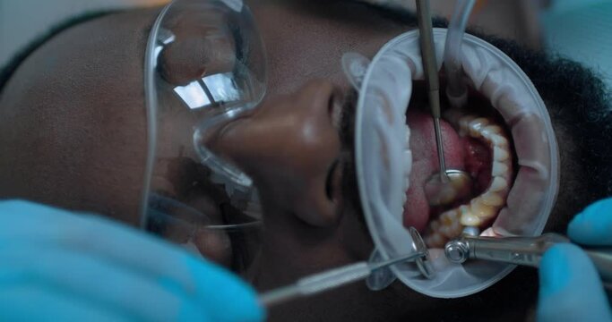 Close-up face of an African American male patient in optragate who is having teeth cleaning procedure by using a dental brush and saliva ejector.