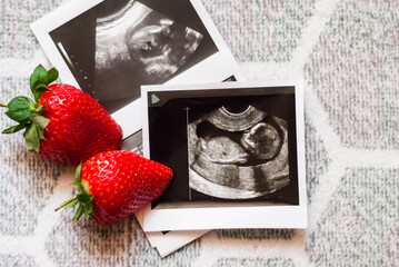 2 strawberry and a photo of a human fetus from an ultrasound scan during pregnancy on a gray background. Baby waiting. Ultrasound results in the 2 trimester of pregnancy. Having a baby with IVF.