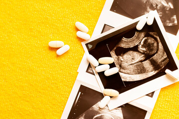 Photos of fetus on ultrasound scan and few pills on right side yellow back. Ultrasound results in...