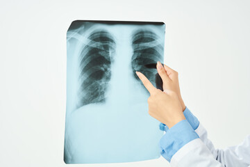 female doctor with glasses in white coat x-ray hospital