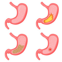 Obraz premium stomach healthy stomach sick set 2 dd ww